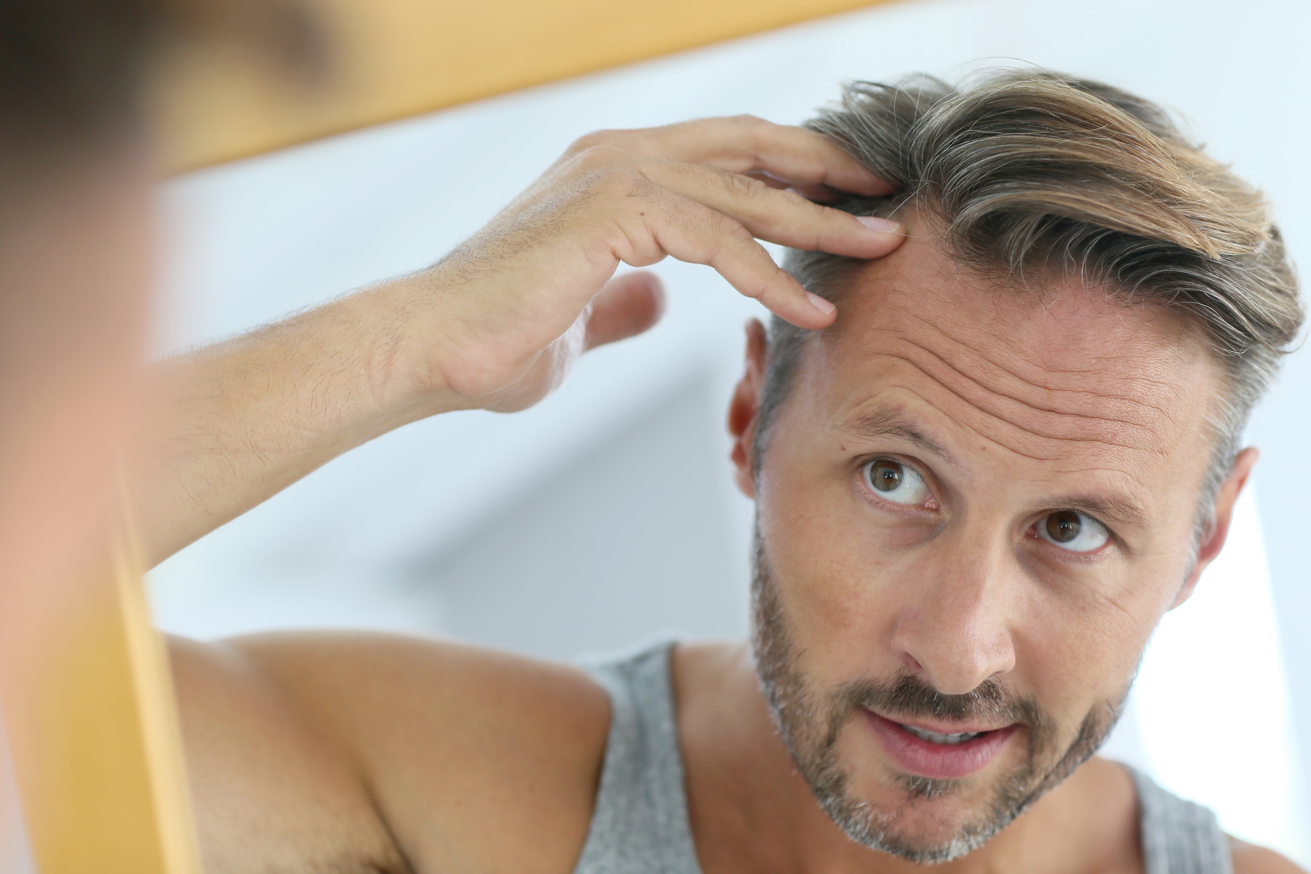 Hair loss: why it happens and how to deal with it